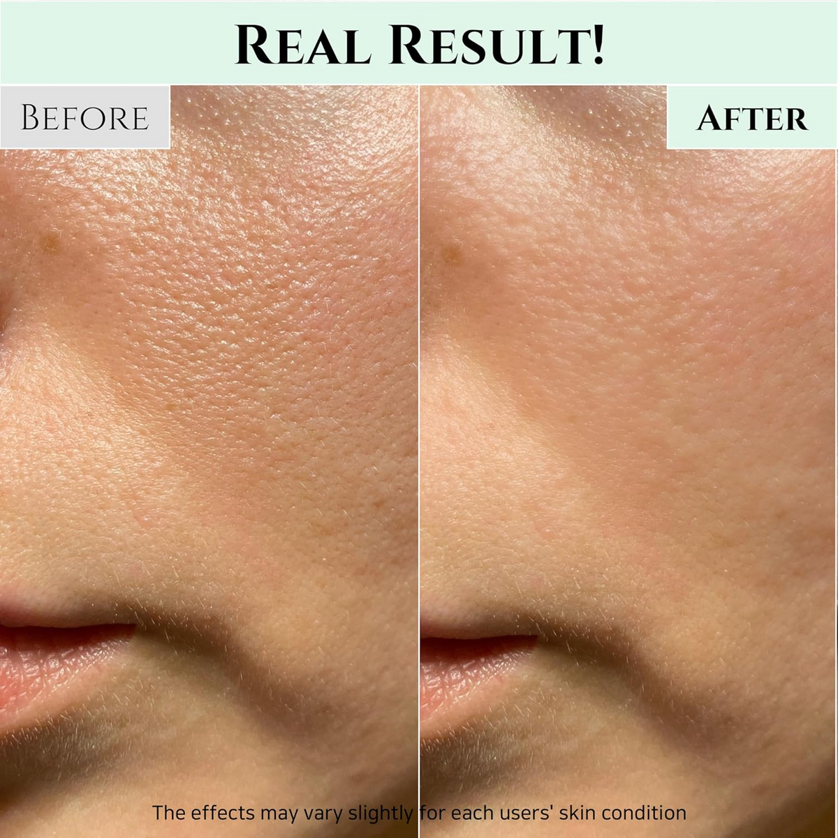 close-up of before and after comparison of skin texture on a person's face.