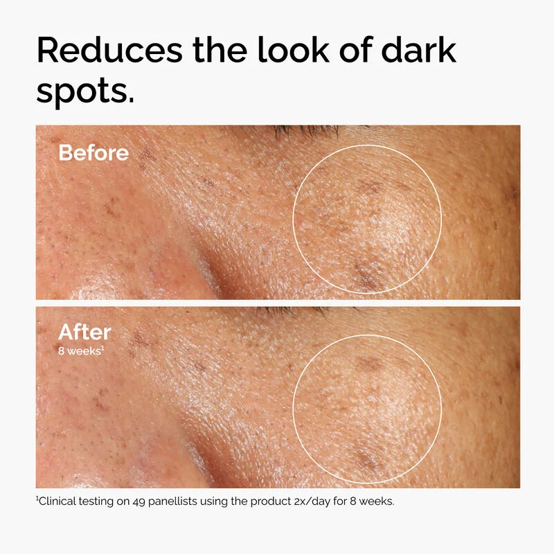 The Ordinary Alpha Arbutin 2% + HA 30mL The Ordinary