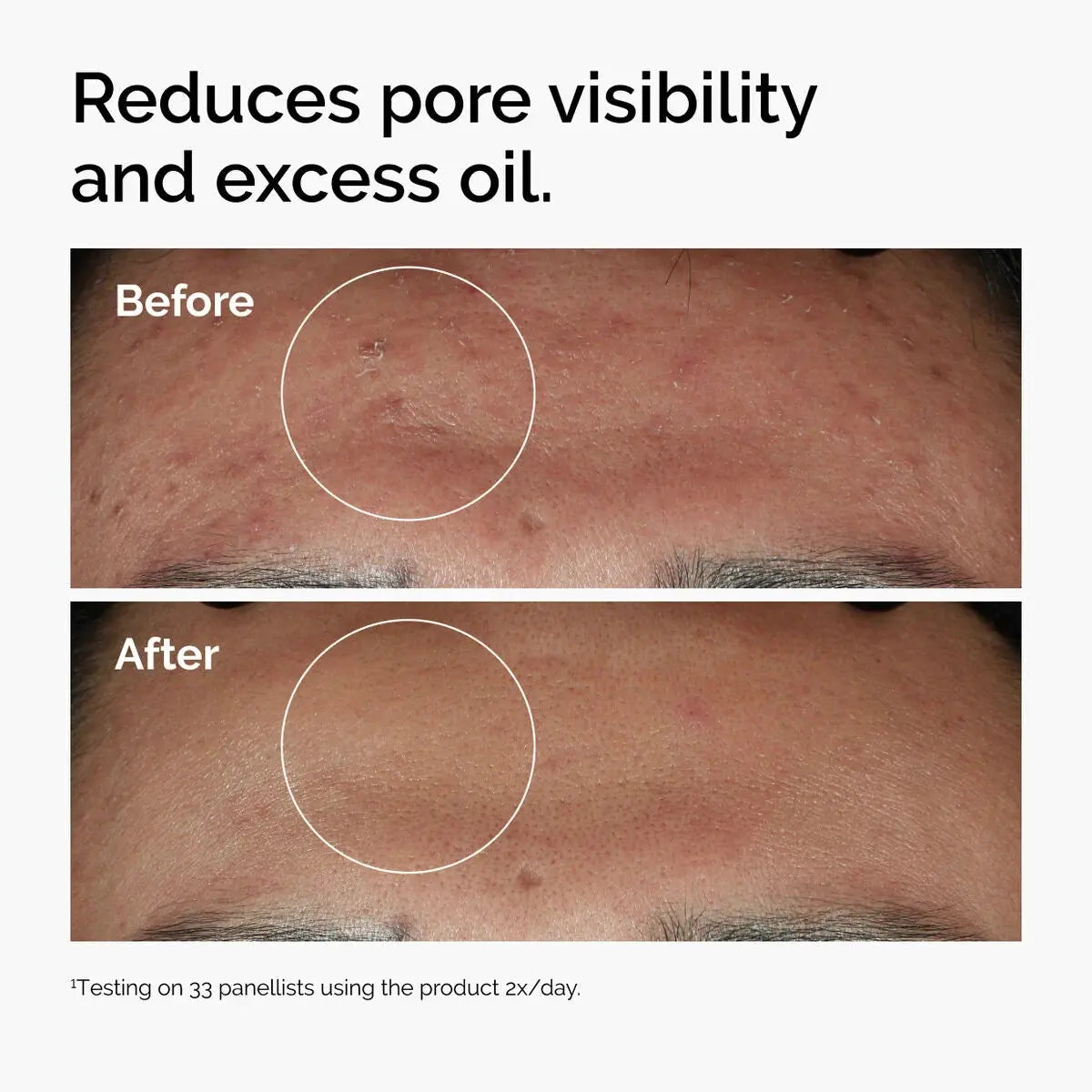 The Ordinary Niacinamide 10% + Zinc 1% Serum, 30 mL The Ordinary