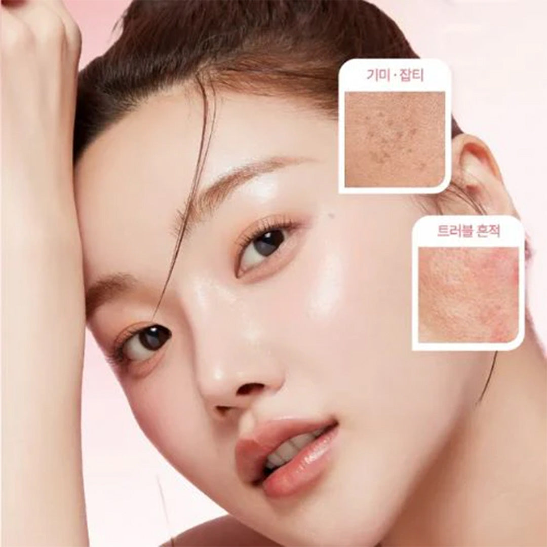 Uneven Skin Texture Treatment Dubai | Smooth Skin Care UAE