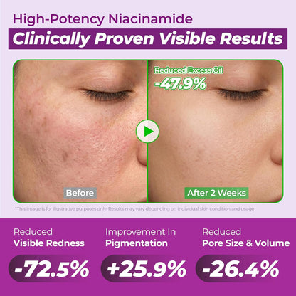 Jumiso Niacinamide 10 Serum 30ml Korean pore minimizing serum with 10% Niacinamide for dark spots, enlarged pores, hyperpigmentation, and brighter skin available in UAE.