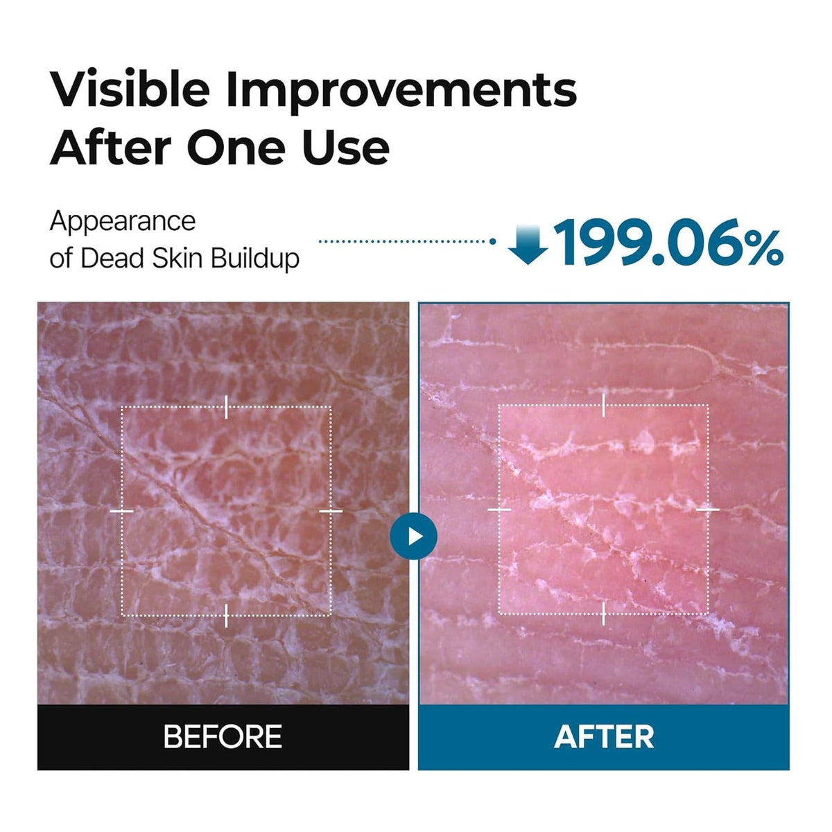 exfoliator for dark knees UAE