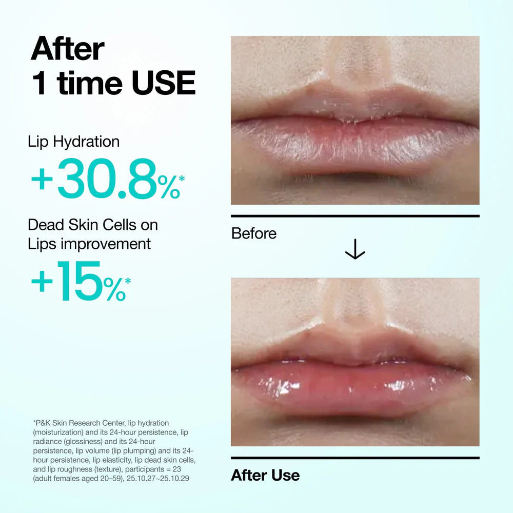 Anua PDRN Hyaluron Lip Serum 10ml Korean hydrating lip serum with PDRN and Hyaluronic Acid for dry lips, lip barrier care, and a naturally glossy finish available in UAE.