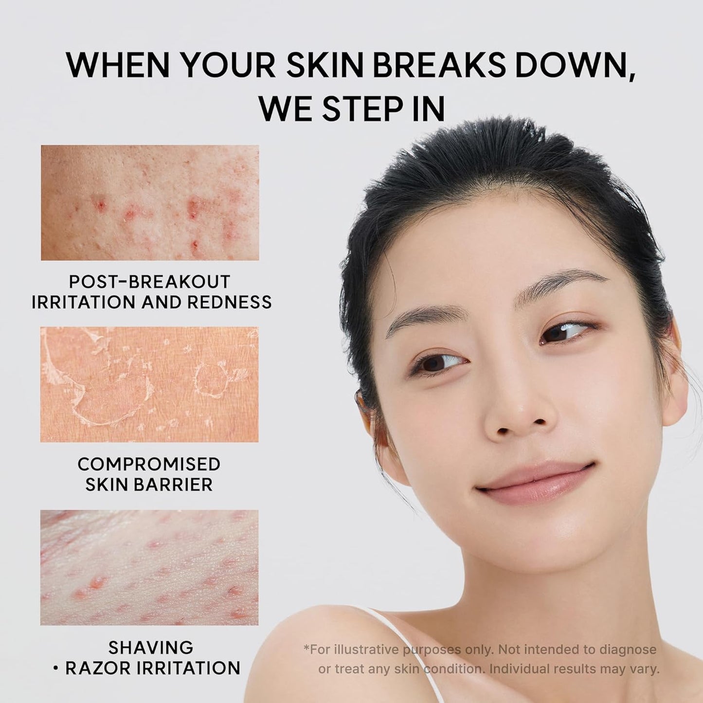 Arencia Eraser Soothing Cream 50ml Korean moisturizer with Centella, Ceramide, Panthenol and Hyaluronic Acid for sensitive skin, soothing hydration and moisture-barrier support in UAE.