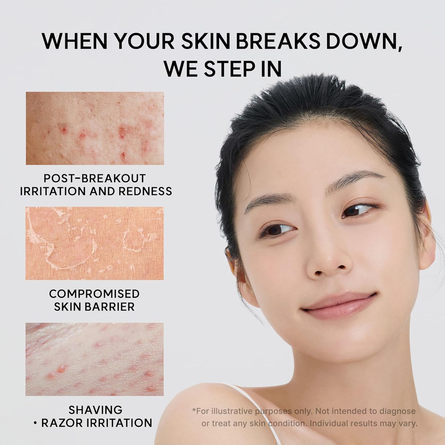 Arencia Eraser Soothing Cream 50ml Korean moisturizer with Centella, Ceramide, Panthenol and Hyaluronic Acid for sensitive skin, soothing hydration and moisture-barrier support in UAE.