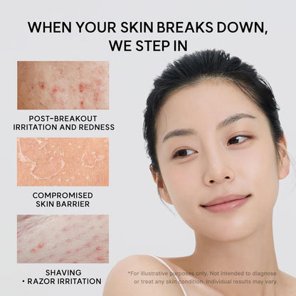 Arencia Eraser Soothing Cream 50ml Korean moisturizer with Centella, Ceramide, Panthenol and Hyaluronic Acid for sensitive skin, soothing hydration and moisture-barrier support in UAE.