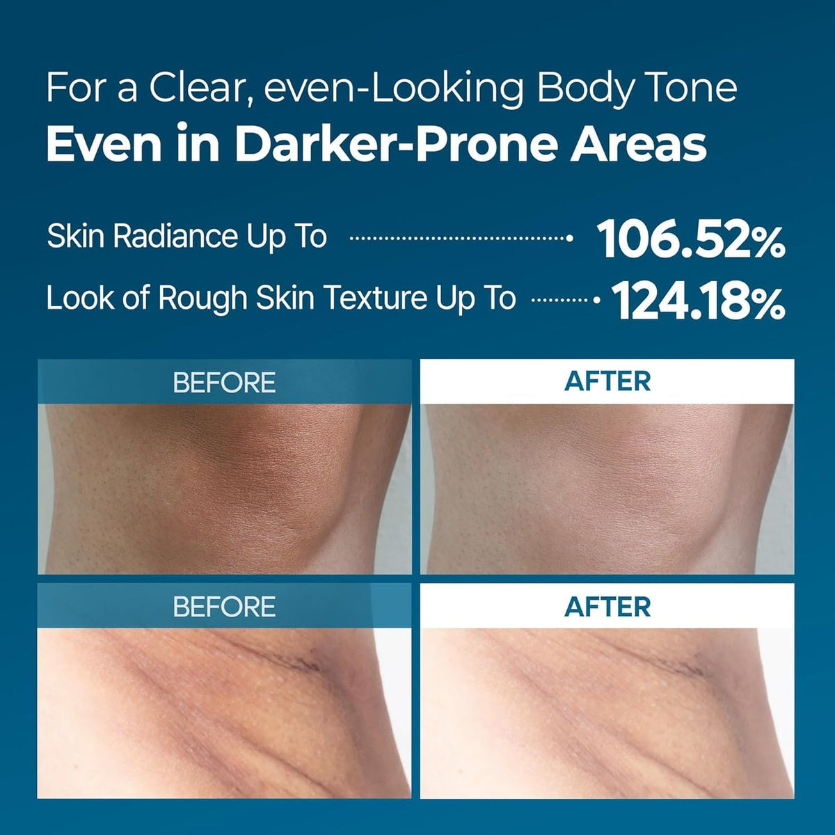 Before and after of Dr. Melaxin Peel Shot TX Spray 200ml