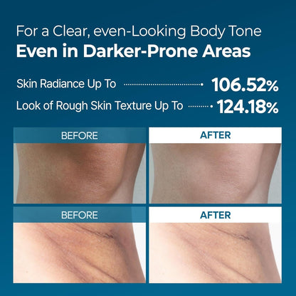 Before and after of Dr. Melaxin Peel Shot TX Spray 200ml