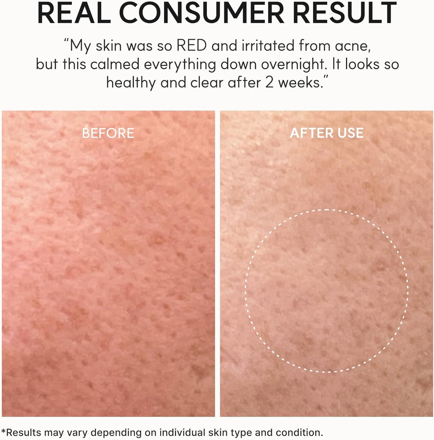 Arencia Eraser Soothing Cream 50ml Korean moisturizer with Centella, Ceramide, Panthenol and Hyaluronic Acid for sensitive skin, soothing hydration and moisture-barrier support in UAE.