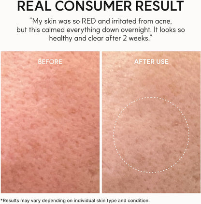 Arencia Eraser Soothing Cream 50ml Korean moisturizer with Centella, Ceramide, Panthenol and Hyaluronic Acid for sensitive skin, soothing hydration and moisture-barrier support in UAE.