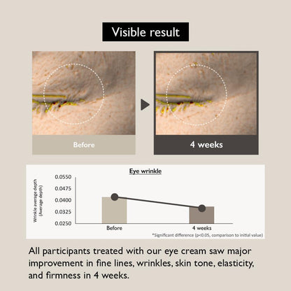 before and after eye wrinkle comparision of using haruharu Bakuchiol Eye Cream