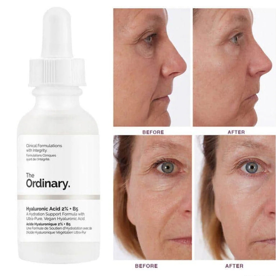 The Ordinary Hyaluronic Acid with 2% + B5 30mL The Ordinary