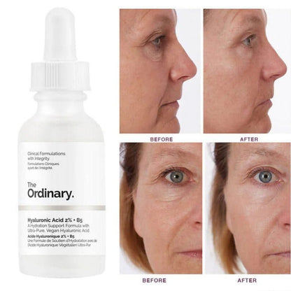 The Ordinary Hyaluronic Acid with 2% + B5 30mL The Ordinary