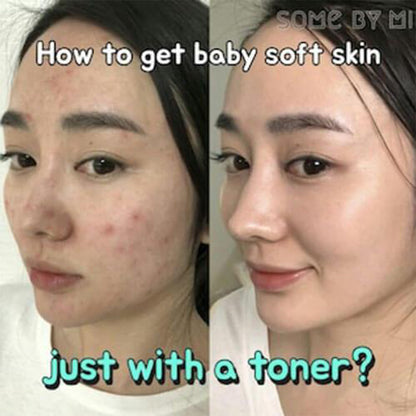 SOME BY MI Aha-Bha-Pha 30 Days Miracle Toner 150 mL SOMEBYMI
