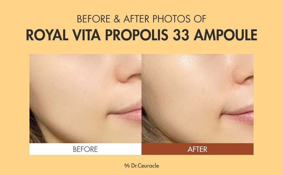 close-up of cheeks before and after using Dr.Ceuracle Royal Vita Propolis 33 Ampoule