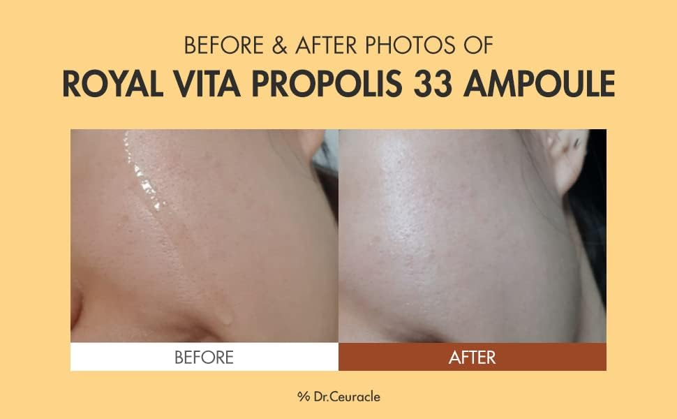 before and after comparision of Dr.Ceuracle Royal Vita Propolis 33 Ampoule