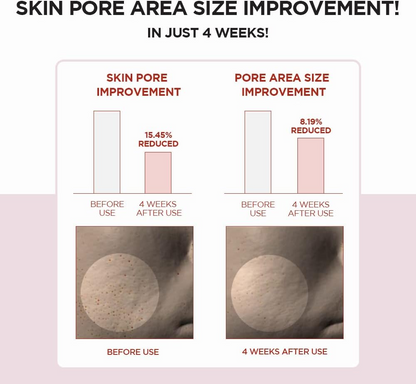 Skin1004 Madagascar Centella Poremizing Clear Toner 210mL Skin1004