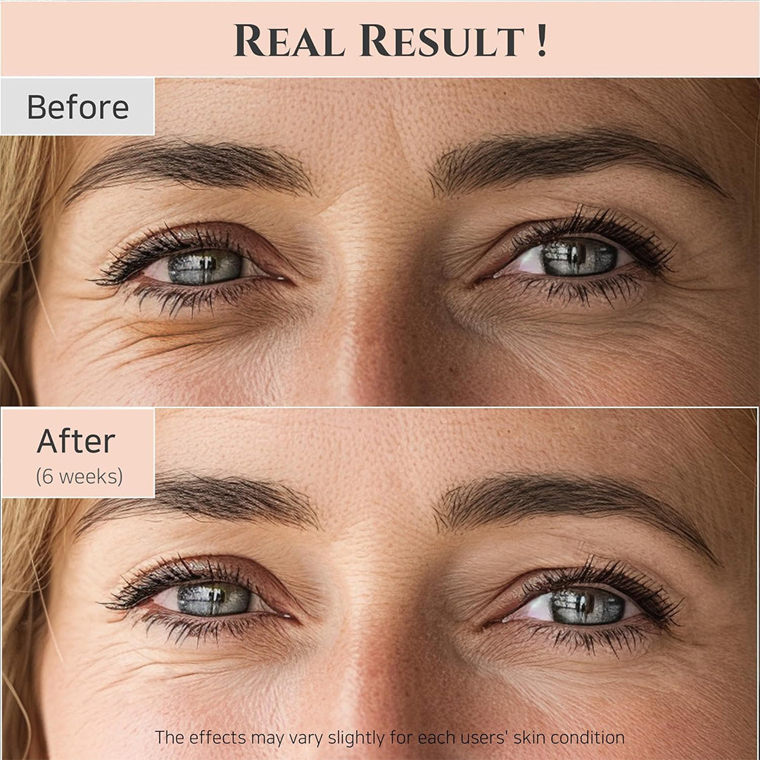 Beauty of Joseon Revive Eye Serum Ginseng + Retinal 30ml, Results