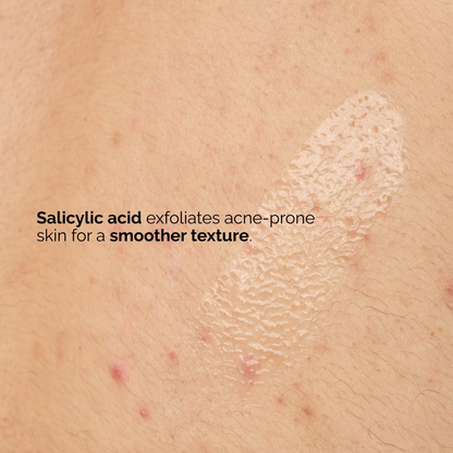 close-up of skin with The Ordinary Salicylic Acid 0.5% Body Serum swatch applied