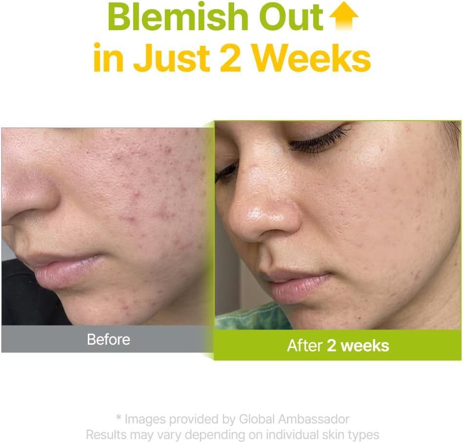 PURITO Tea Tree blemish serum Abu Dhabi