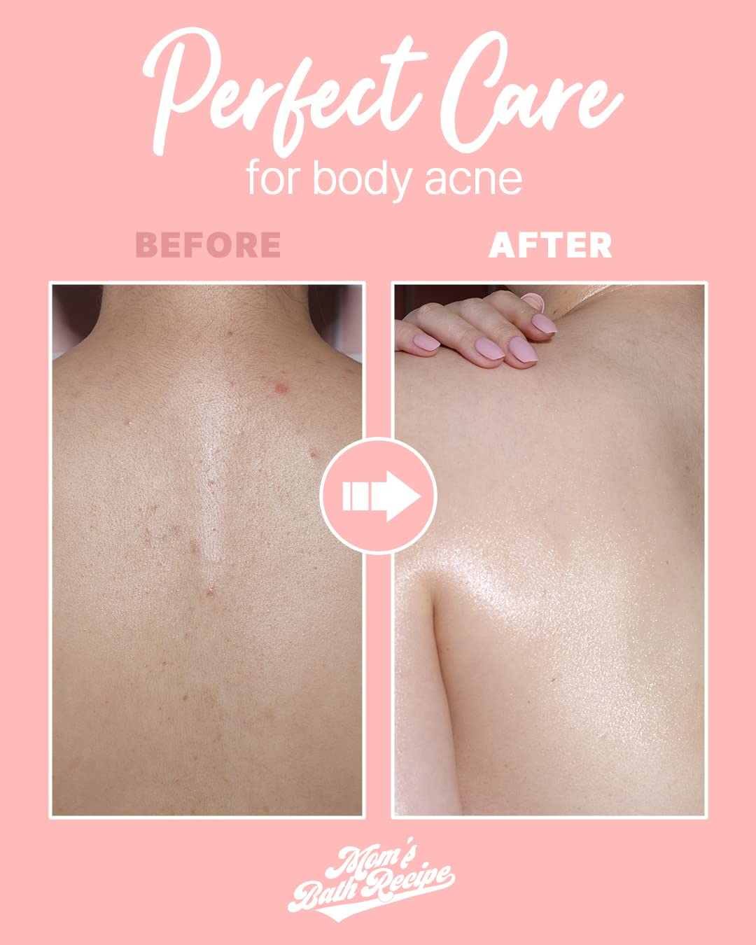Mom’s Bath Recipe Body Peeling Pad Trouble Care (8 Sheets) Mom's Bath Recipe
