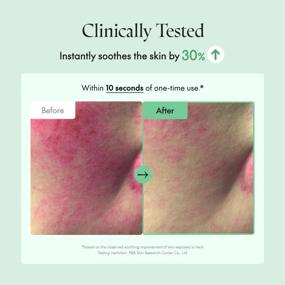 before and after skin comparision of skin soothness