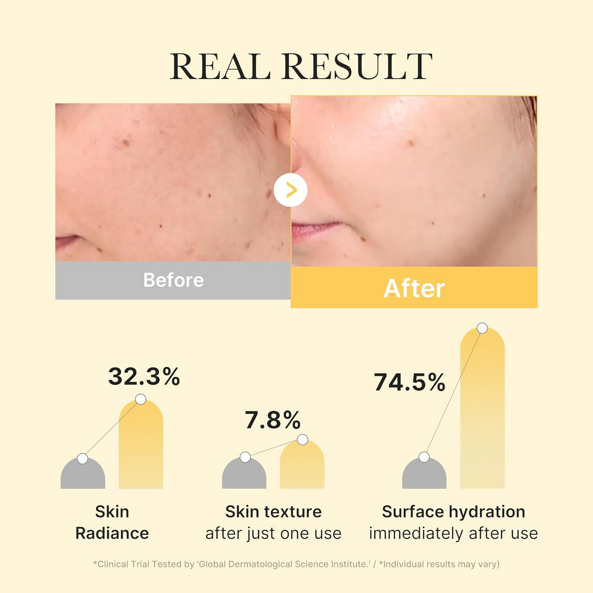 before and after comparison of skin