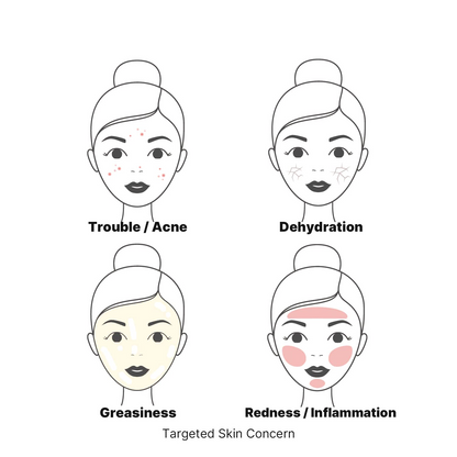 illustrated faces showing targeted concerns: acne, dehyderation, greasiness and redness