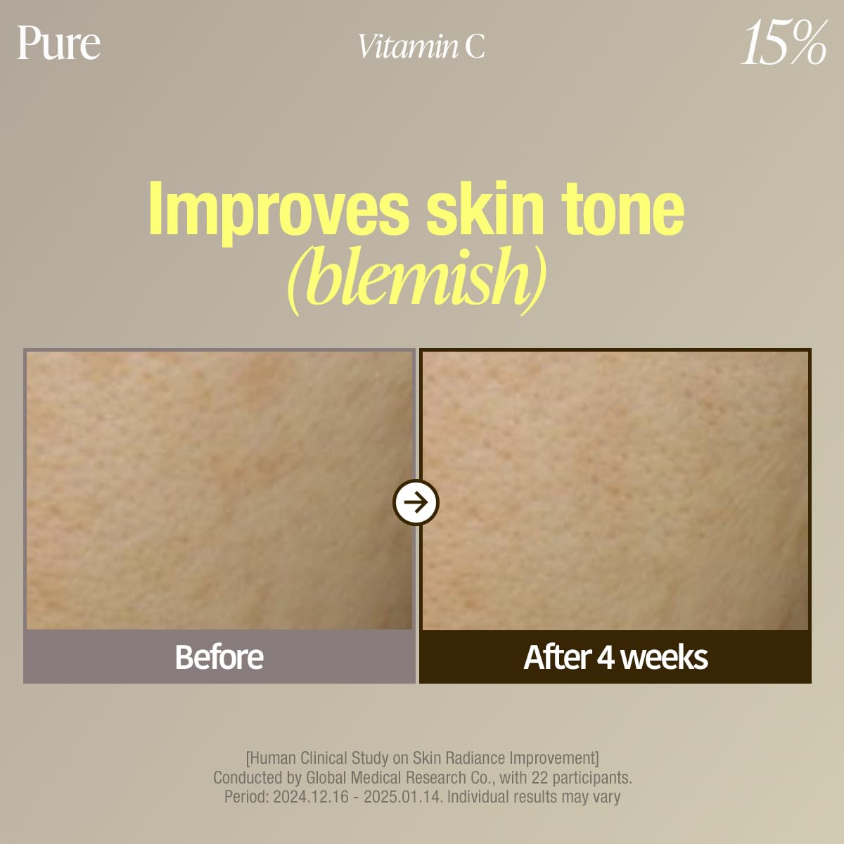 before and after comparison of skin tone
