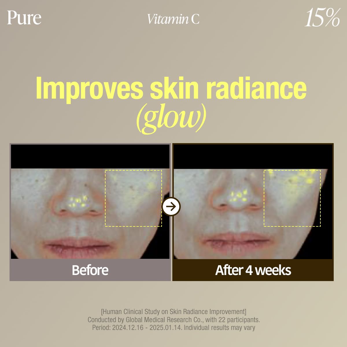before and after skin radiance comparison