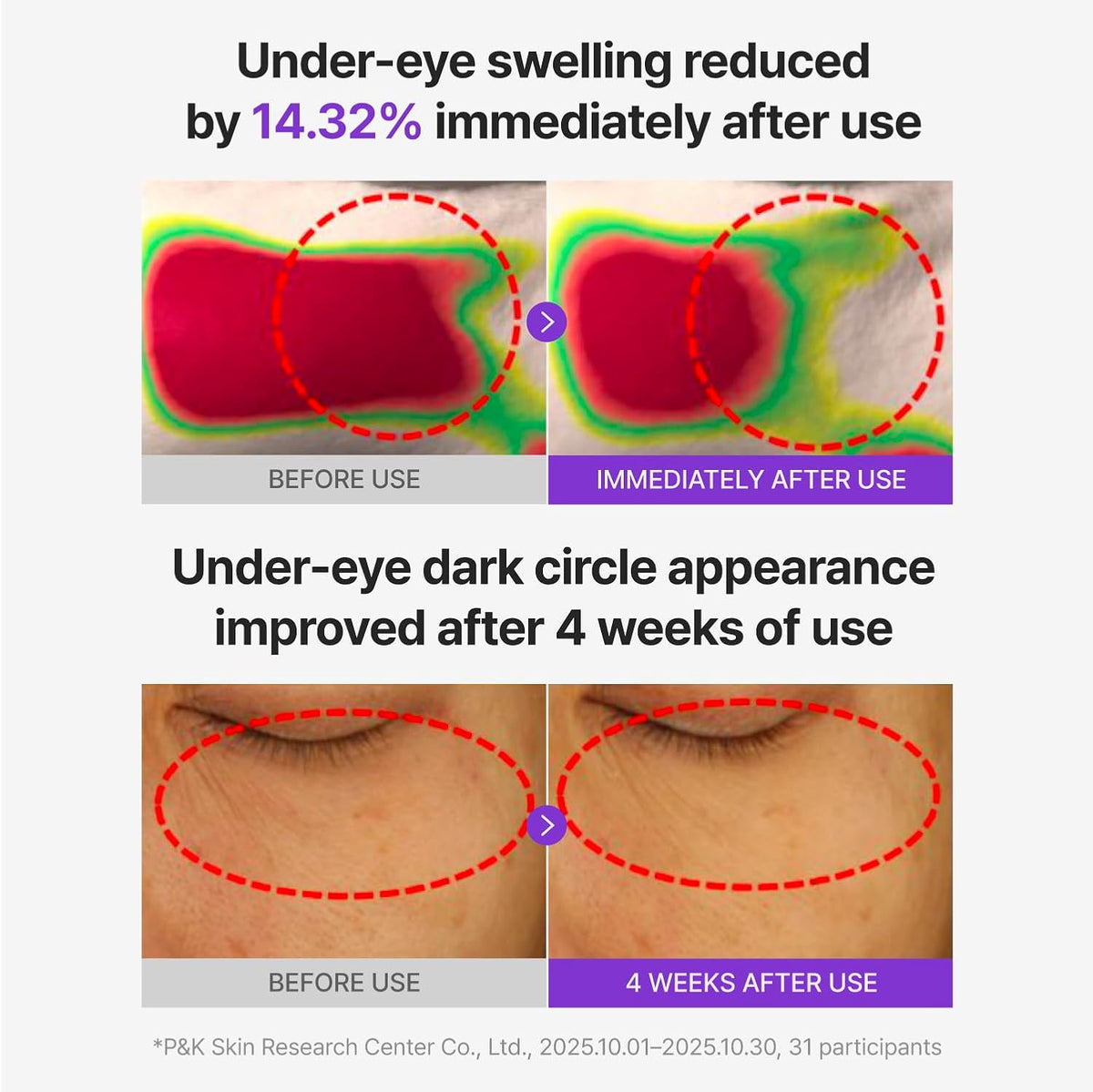 Centellian24 360° Shot PDRN Glowing Eye Patch | PDRN Brightening & Firming Eye Mask UAE