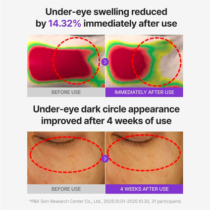 Centellian24 360° Shot PDRN Glowing Eye Patch | PDRN Brightening & Firming Eye Mask UAE