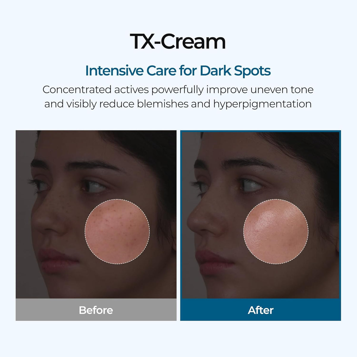 Dr. Melaxin TX Cream for hyperpigmentation Dubai