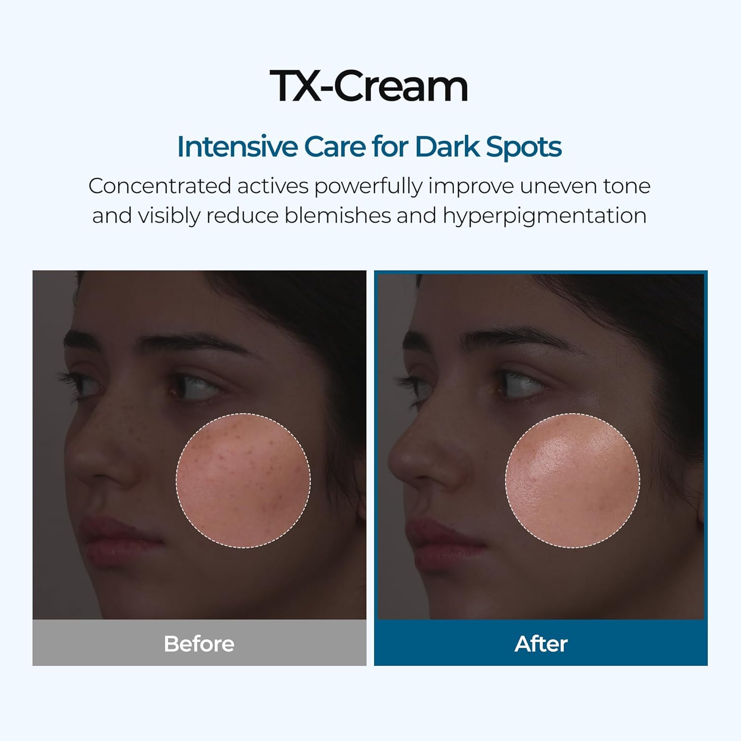 Dr. Melaxin TX Cream 50g