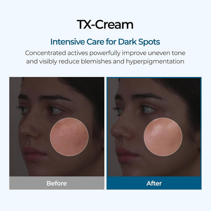 Dr. Melaxin TX Cream for hyperpigmentation Dubai
