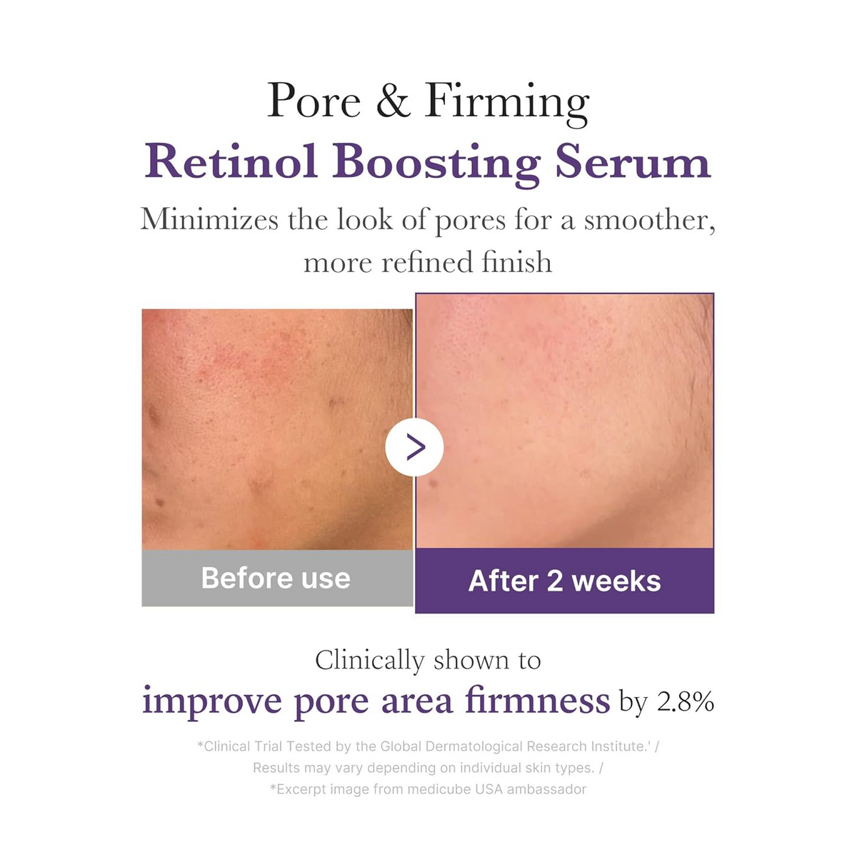 before and after comparision of pore and firming on skin