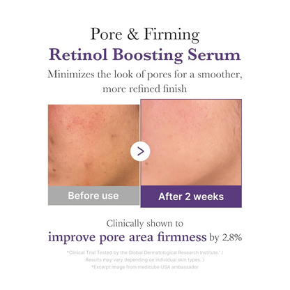 before and after comparision of pore and firming on skin