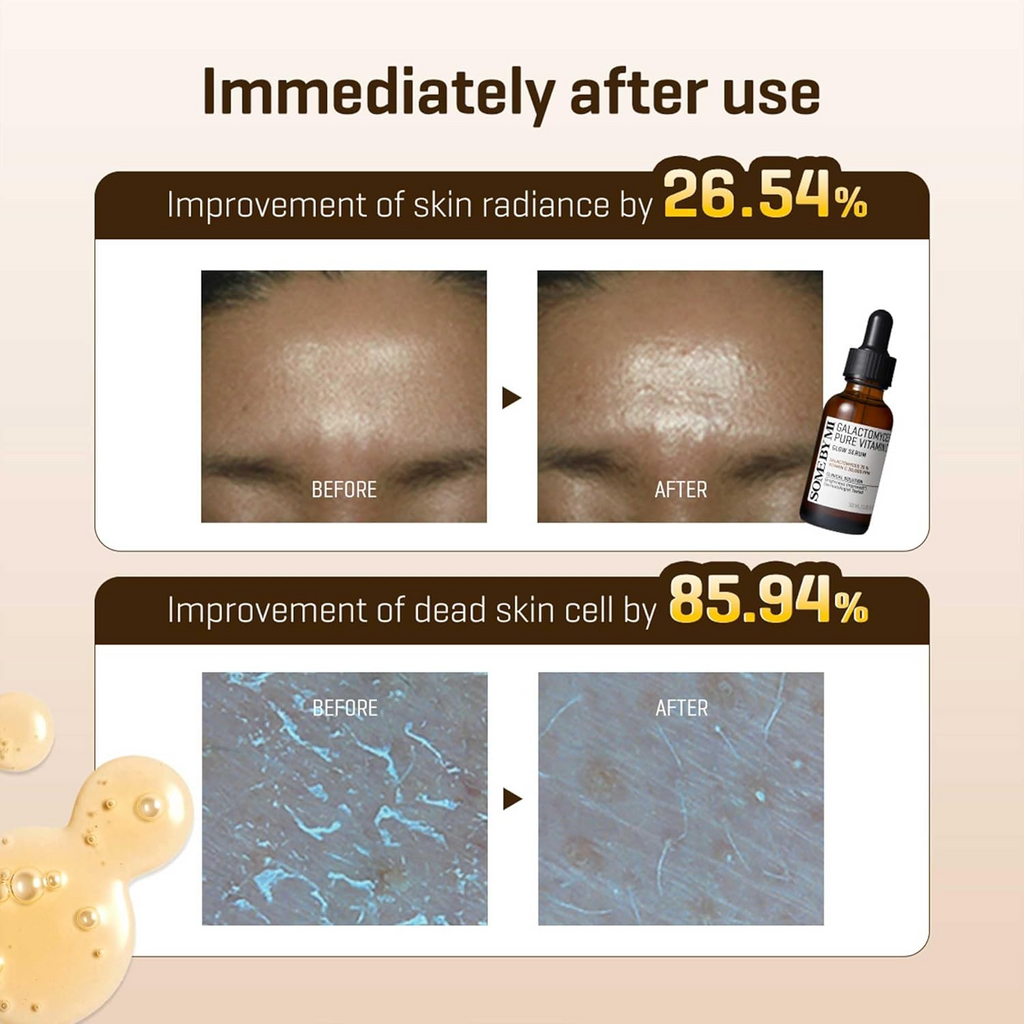 SOME BY MI Galactomyces Pure Vitamin C Glow Serum 30mL SOMEBYMI