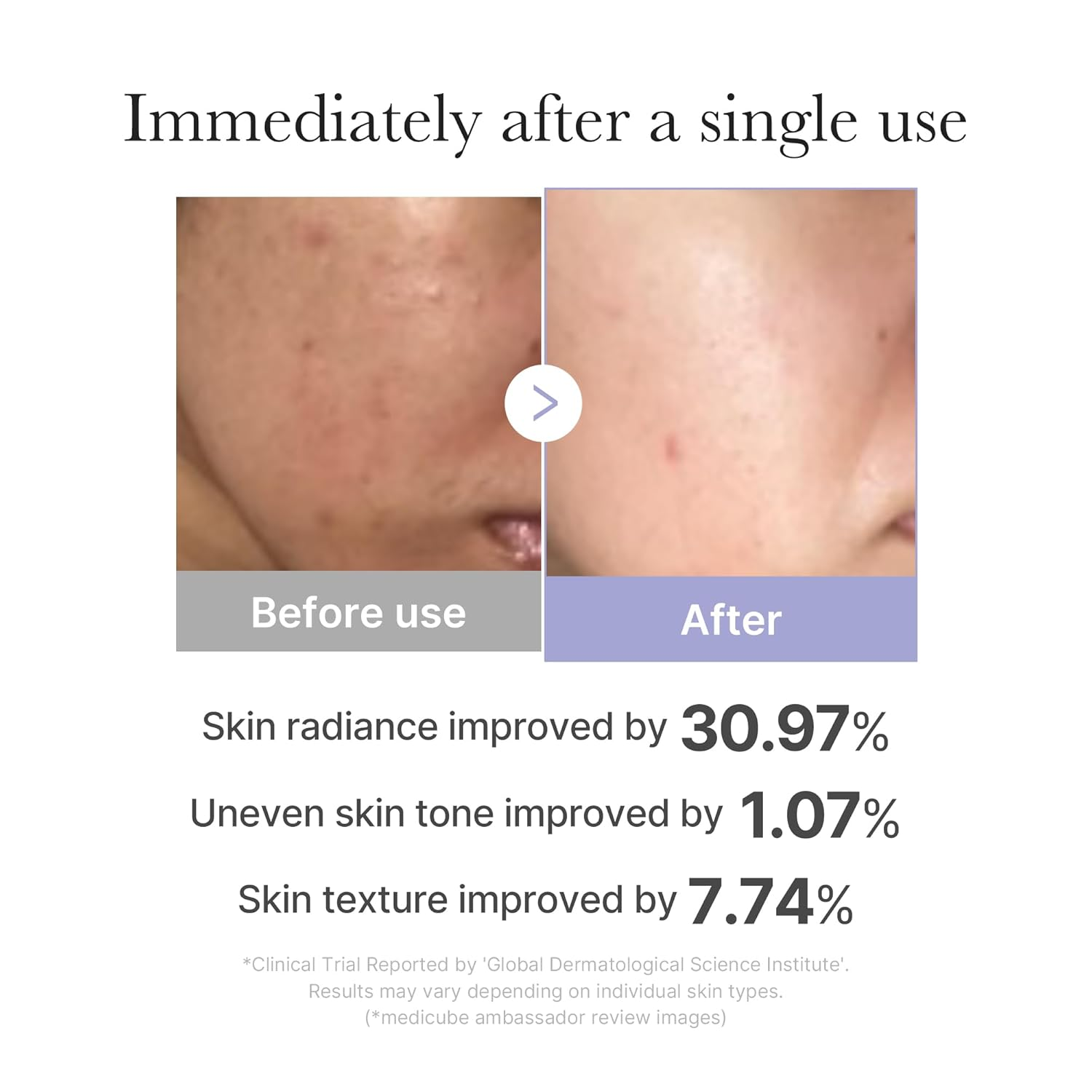 before and after comparison of skin radiance, tone and texture.