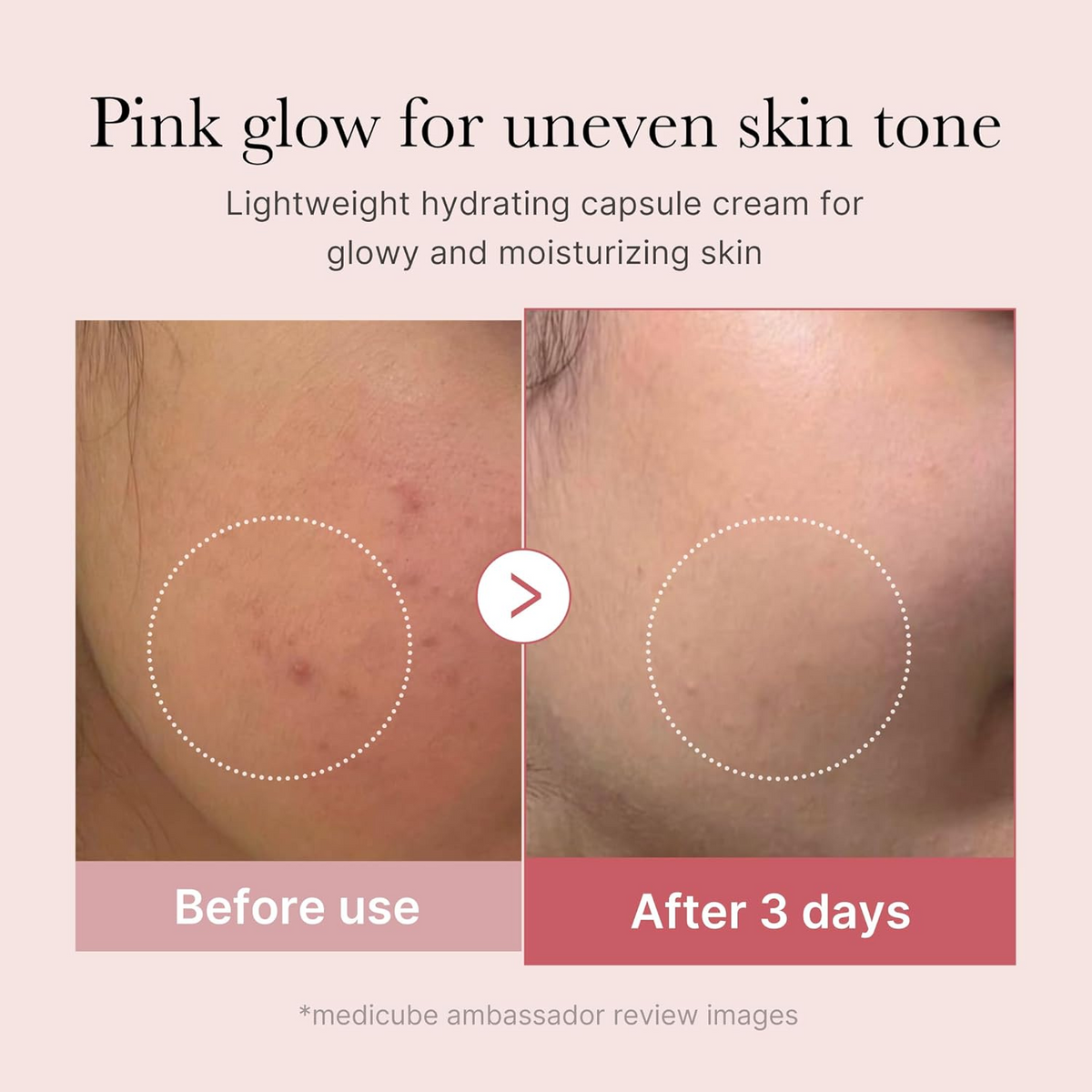 before and after comparison of uneven skin 