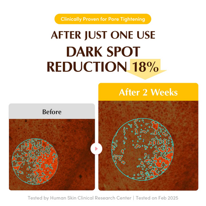 before and after comparision of dark spot reduction