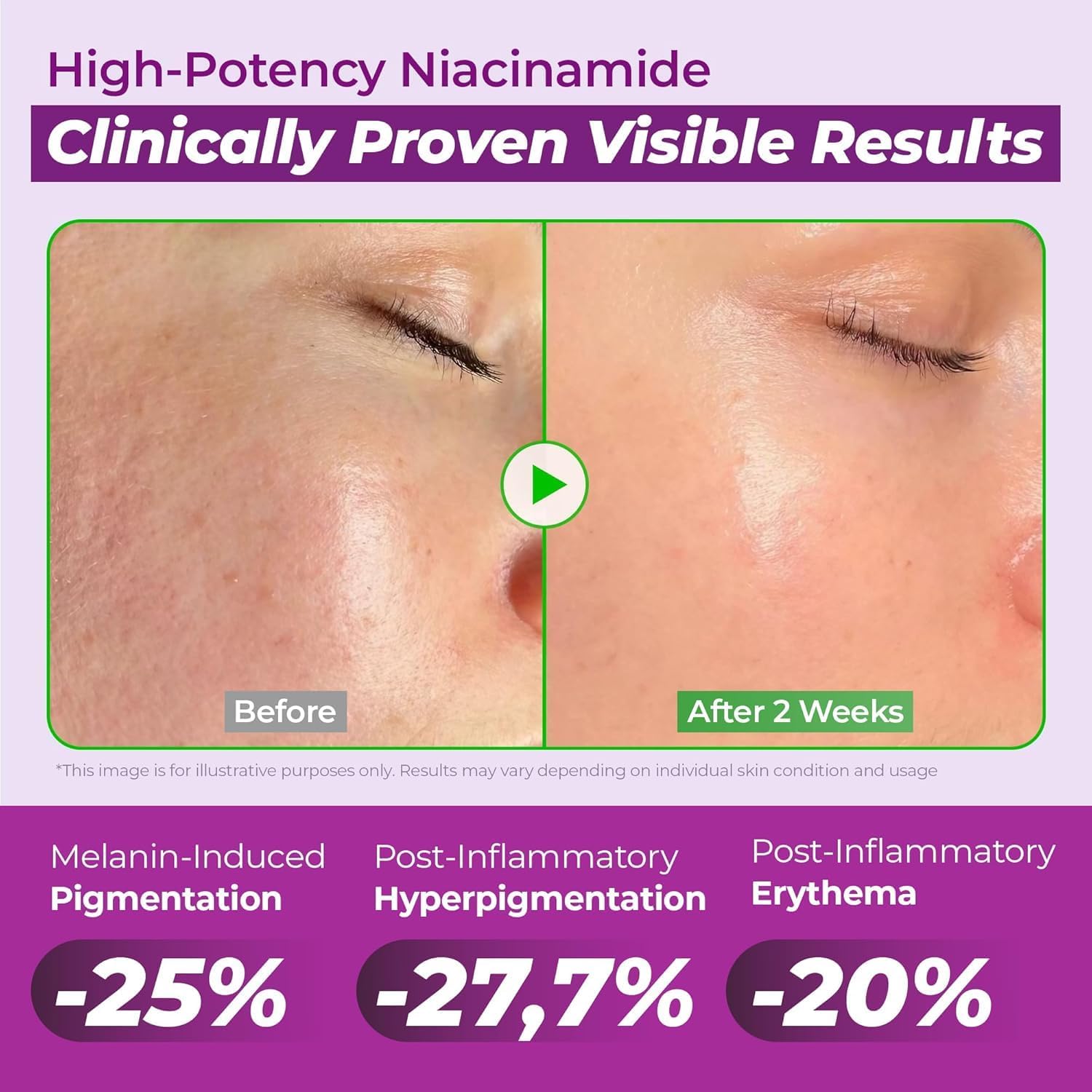 Jumiso Niacinamide 20 Serum 30ml Korean dark spot correcting serum with 20% Niacinamide for hyperpigmentation, post-acne marks, uneven skin tone, and brighter skin available in UAE.