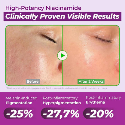 Jumiso Niacinamide 20 Serum 30ml Korean dark spot correcting serum with 20% Niacinamide for hyperpigmentation, post-acne marks, uneven skin tone, and brighter skin available in UAE.