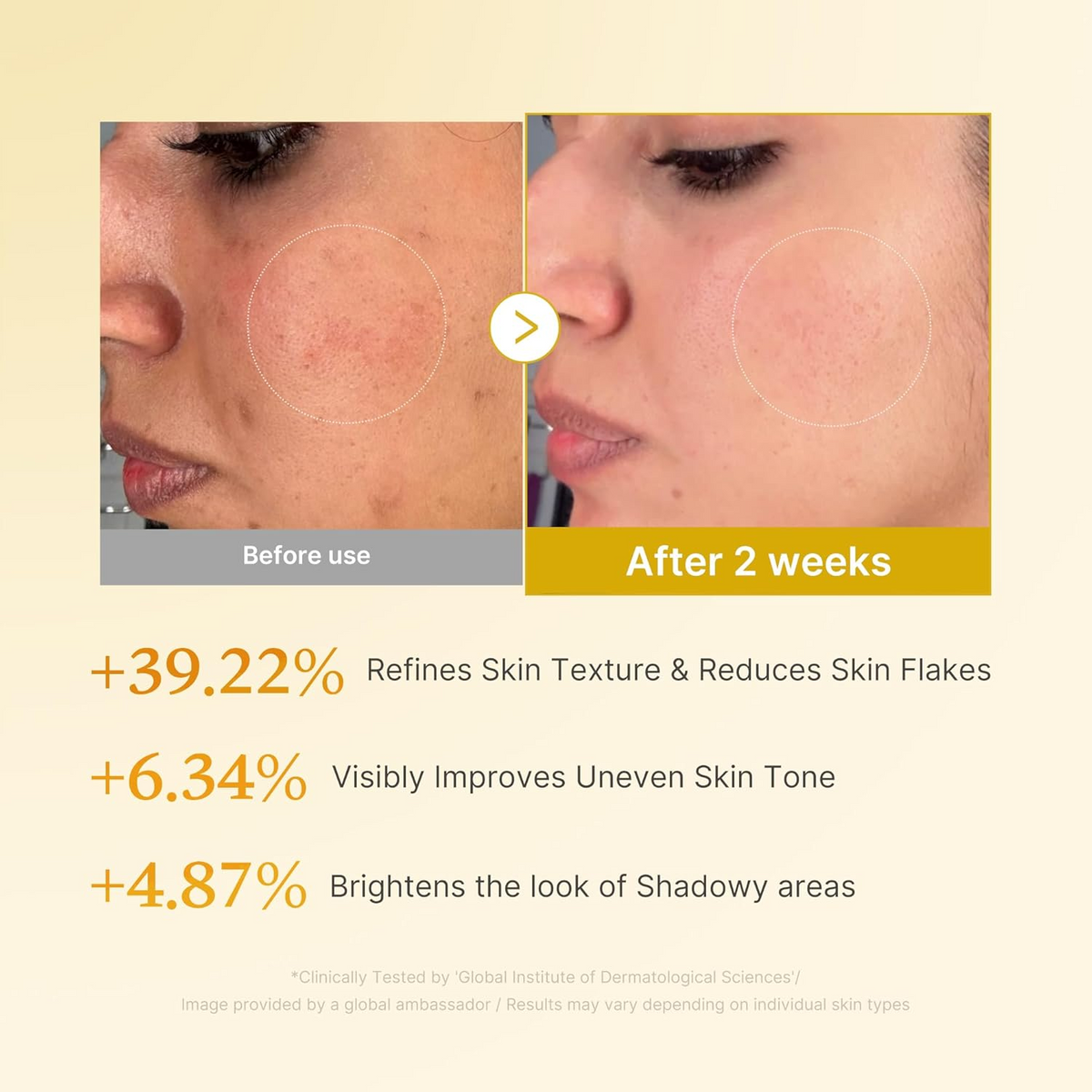 before and after skin texture, tone and brightness comparison
