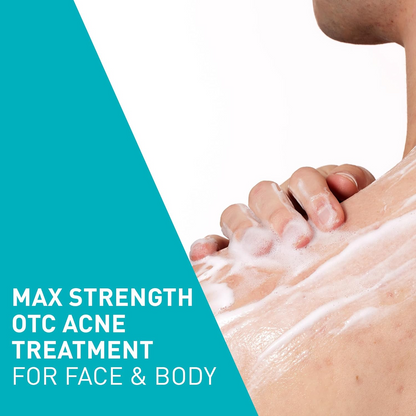 Person applying CeraVe Acne Foaming Cream Wash to body 