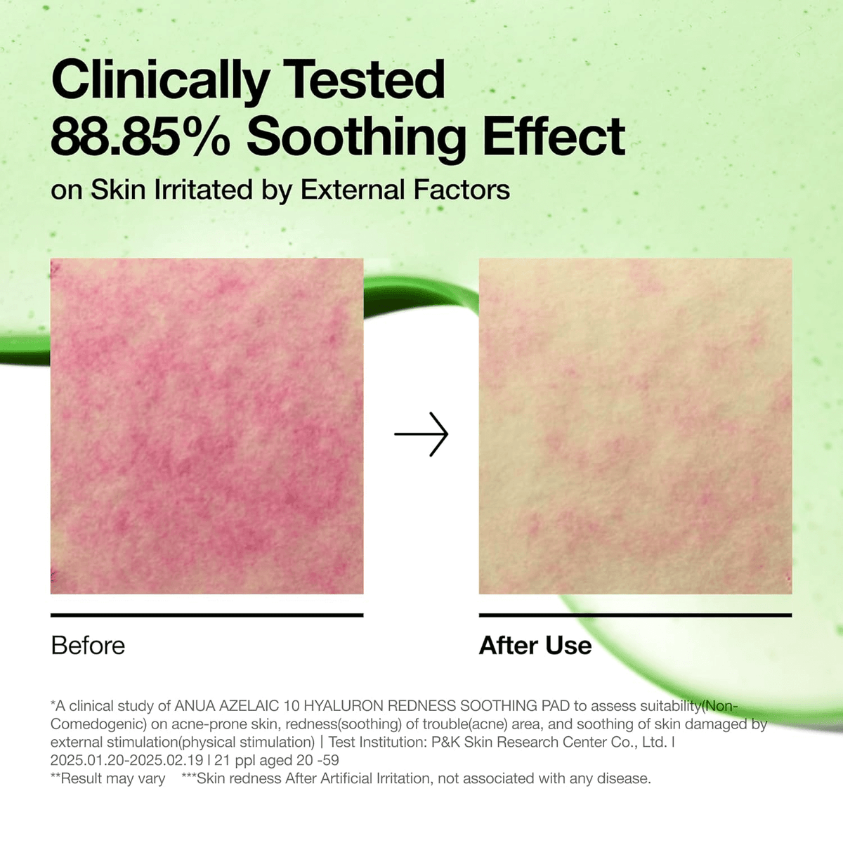 comparision of before and after effects of anua soothing pad