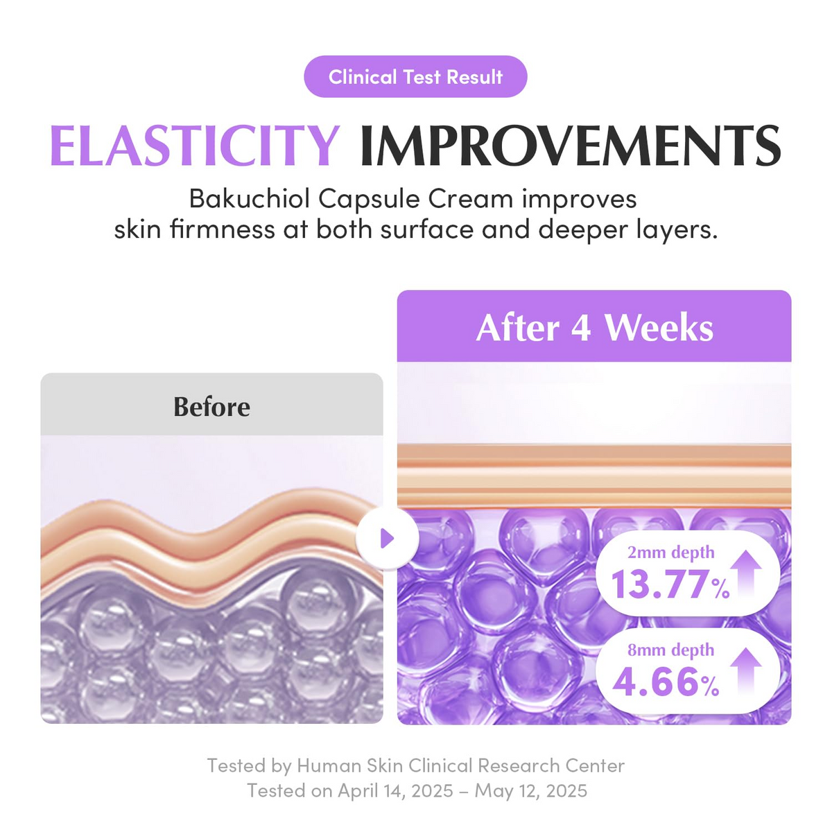 before and after comparison of elasticity improvements