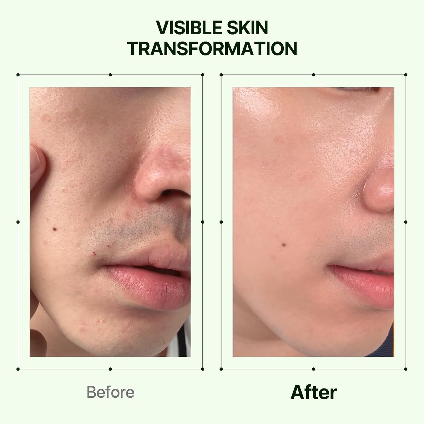 Orien Mugwort and Collagen Pore Serum 30ml Korean facial serum for visible pore care, hydration, smoother texture and firmer-looking skin in UAE.