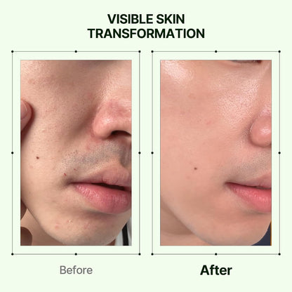 Orien Mugwort and Collagen Pore Serum 30ml Korean facial serum for visible pore care, hydration, smoother texture and firmer-looking skin in UAE.