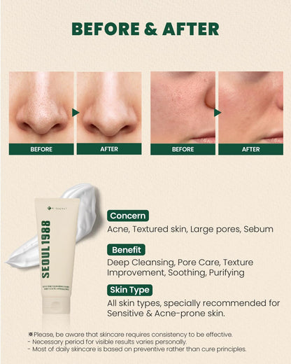Seoul 1988 Cleansing Foam, Pine Cica 1% + Probiotics 150 ML